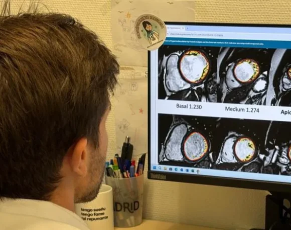 Un equipo liderado por el doctor Pablo García-Pavía, jefe de la Unidad de Cardiopatías Familiares del Hospital Universitario Puerta de Hierro de Majadahonda de la Comunidad de Madrid y del grupo de miocardiopatías hereditarias del Centro Nacional de Investigaciones Cardiovasculares Carlos III (CNIC), y a su vez cardiólogo del Centro de Investigación Biomédica en Red de Enfermedades Cardiovasculares (CIBERCV), ha demostrado que la hipertrabeculación ventricular izquierda, una característica anatómica del corazón que tradicionalmente se asociaba a peor pronóstico, no conlleva una peor evolución en los pacientes con miocardiopatía dilatada.